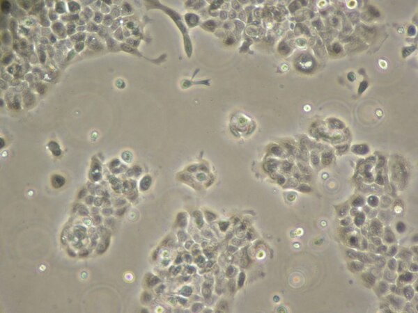 UM-SCC-104 HPV-16 Positive Squamous Carcinoma Cell Line | SCC072